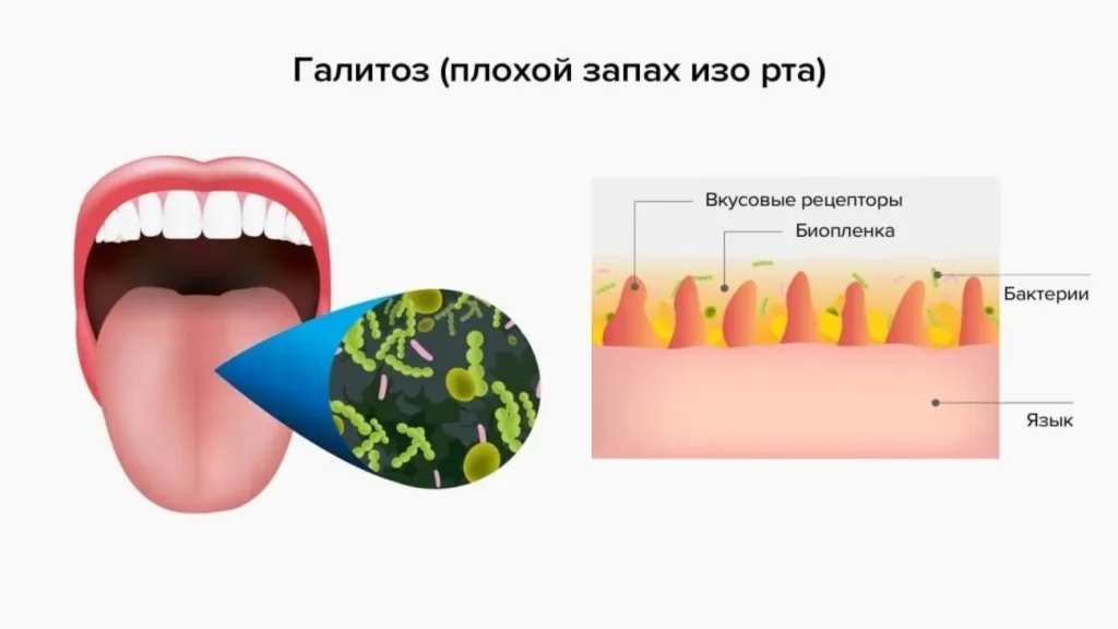 Detoxin - sastav - iskustva - rezultati - recenzije - cijena - Hrvatska - gdje kupiti - narudžba - u ljekarnama